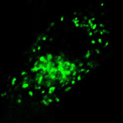 Pancreatic Islets: Structure, Hormones, and Clinical ... - Quizlet