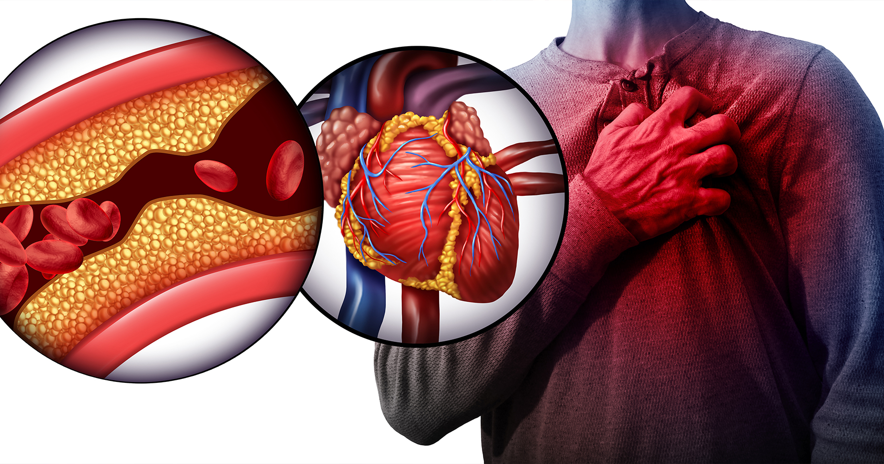 Image of heart and arteries in the body.