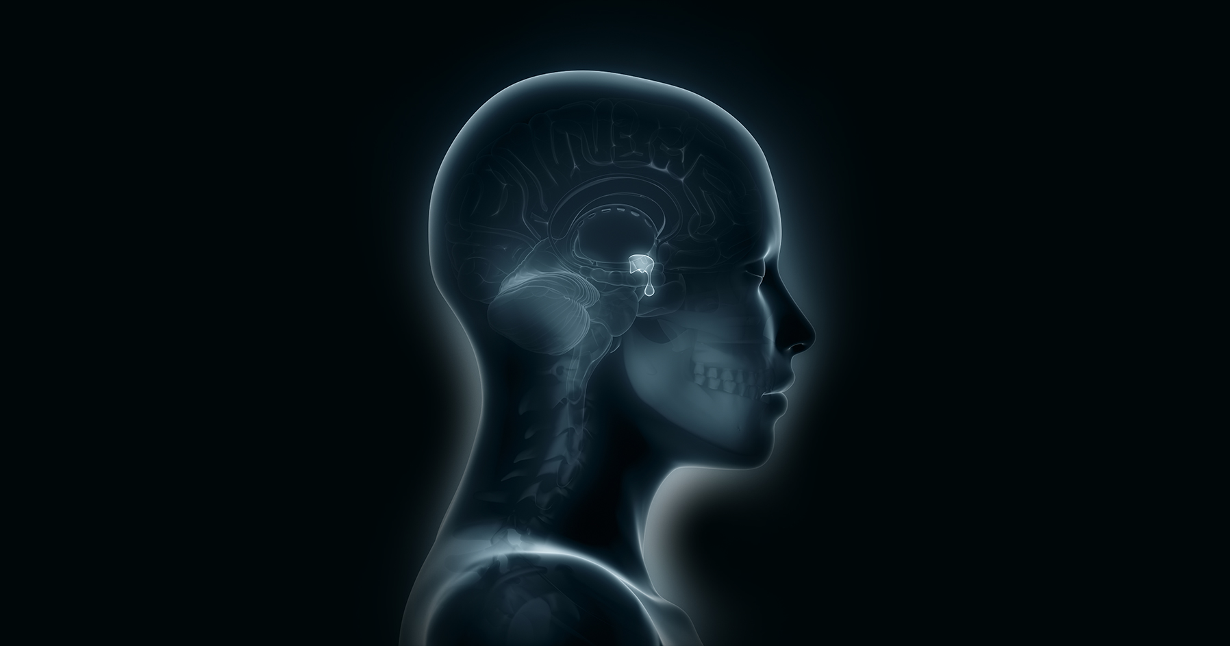 Image of gland in human head responsible for hypopituitarism. 