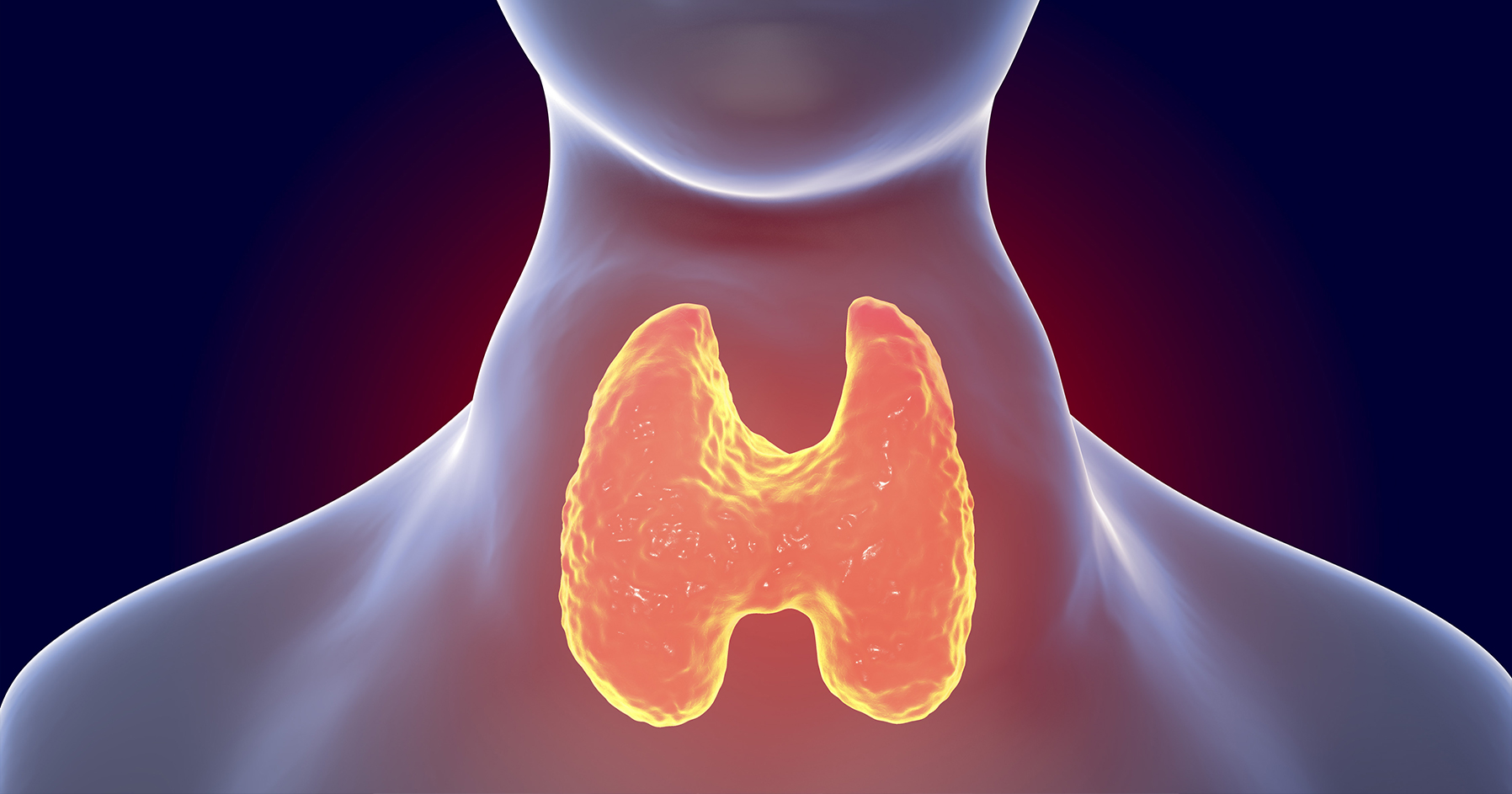 Image of glands in body responsible for Graves’ disease.