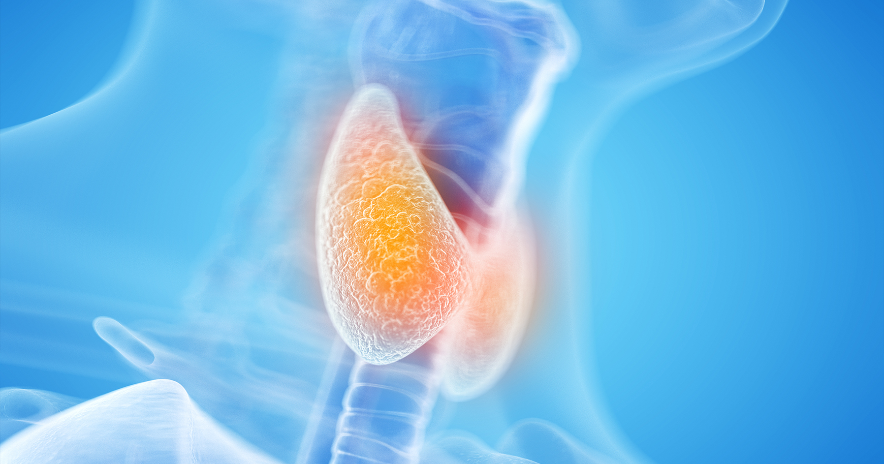 Image of thyroid nodules.