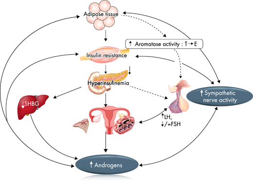 Figure 2 - Scientific Statement on the Diagnostic Criteria, Epidemiology, Pathophysiology, and Molecular Genetics of Polycystic Ovary Syndrome